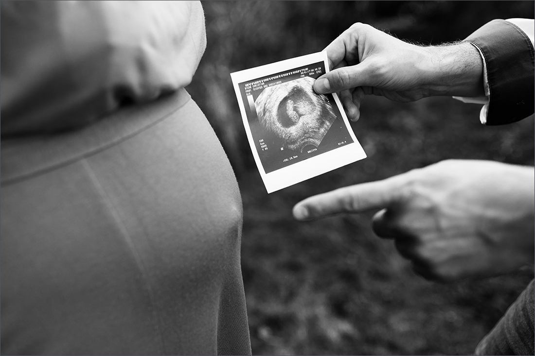 Babybauch Fotoshooting - Ultraschallbild